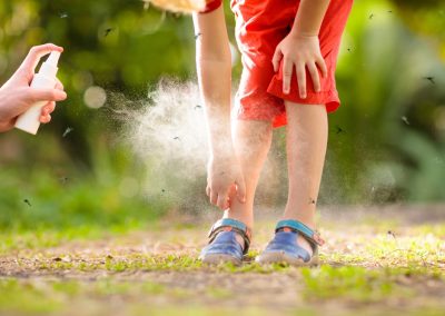 Mosquito,On,Kids,Skin.,Little,Boy,Attacked,By,Mosquitoes,In