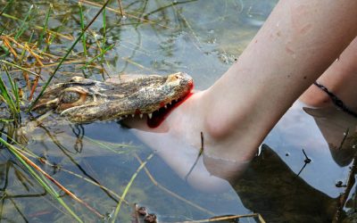 A Florida Gator Bit Off Her Arms While Her Boyfriend Fought To Save Her