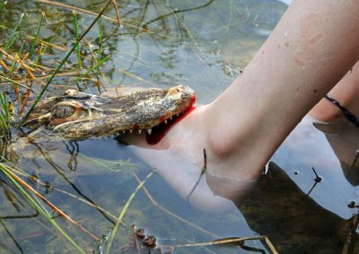 A Florida Gator Bit Off Her Arms While Her Boyfriend Fought To Save Her A,Small,Alligator,Attacking,A,Foot,In,Shallow,Water.,The