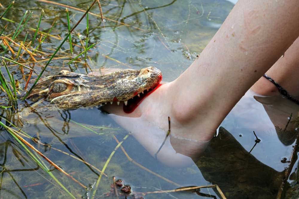 A Florida Gator Bit Off Her Arms While Her Boyfriend Fought To Save Her