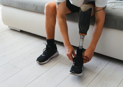 Ron DeSantis Just Made Miami-Dade County Pay the Man Their Bus Driver Left Legless in a Crosswalk Thoughtful,Young,Pensive,Man,Amputee,With,Prosthetic,Leg,Disability,Above
