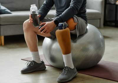 Close,Up,Of,Unrecognizable,Man,With,Prosthetic,Leg,Sitting,On