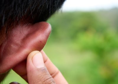 A Florida Mom Bit Off Her Husband’s Ear on I-95 and Then Called 911 to Say He Hit Her Close-up,Of,Ear,With,Red,Bump,From,Hornet,Sting.,Highlights